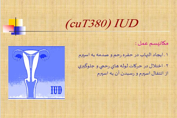 پاورپوینت IUD