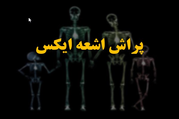 پاورپوینت پراش اشعه ایکس