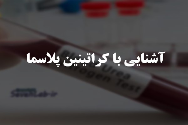 پاورپوینت آشنایی با کراتینین پلاسما