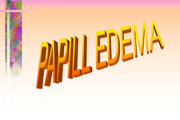 پاورپوینت PAPILL EDEMA