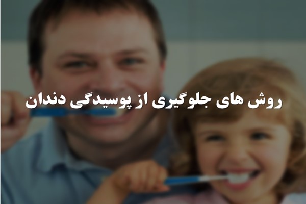 پاورپوینت روش های جلوگیری از پوسیدگی دندان