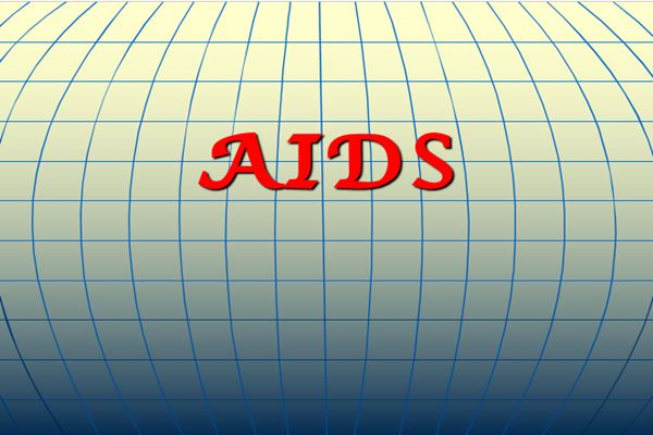 پاورپوینت AIDS