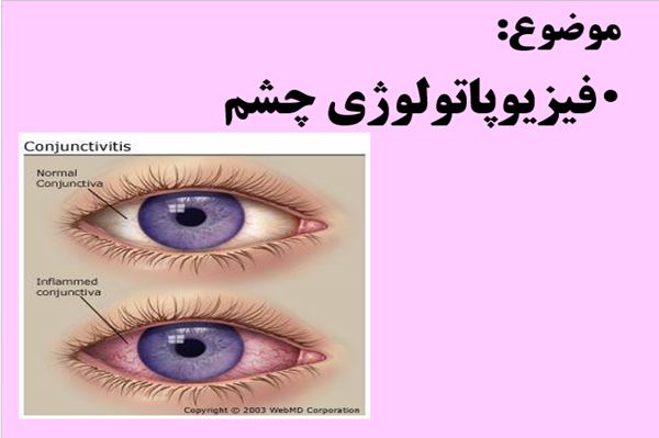 پاورپوینت فیزیوپاتولوژی چشم